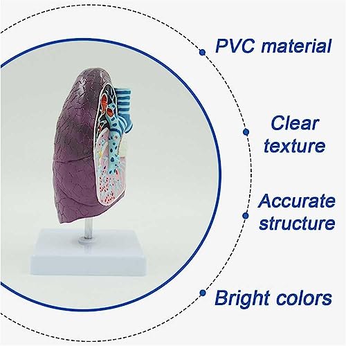 Modelo de cáncer de pulmón 2:3 para estudios e investigaciones médicas 7