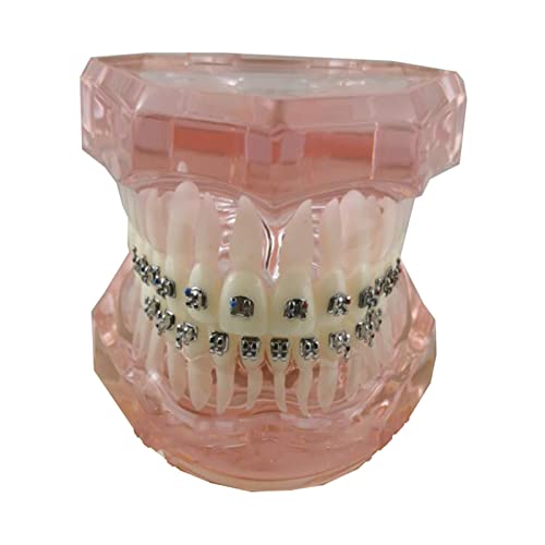 SdaryWare Modelo de enseñanza de ortodoncia Dental, Modelo de Dientes estándar con Brackets metálicos y alambres para educación, Estudio y Herramientas explicativas.