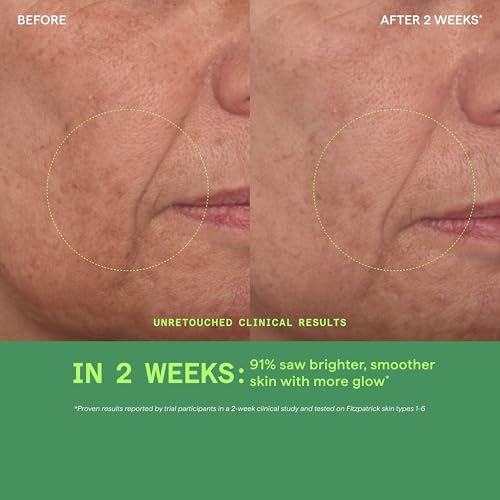 Murad Vita-C Glycolic Serum, view 5