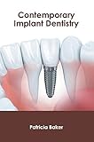Contemporary Implant Dentistry