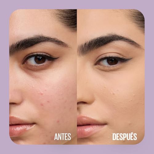 La Mejor Recopilación de Superstay base para comprar online. 30 Imagen adicional