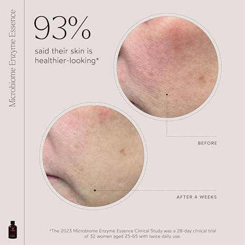 True Botanicals - Microbiome Enzyme Essence 118 Ml - 6