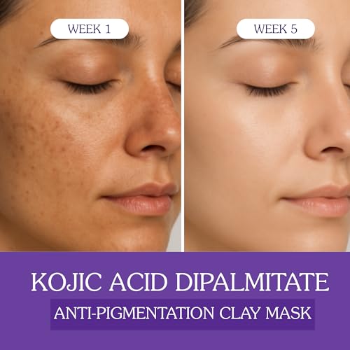 Image of Bake 2% Kojic Acid Dipalmitate Anti-Pigmentation Clay Mask for Dark Spots, Tan & Uneven Skin Tone - 100g
