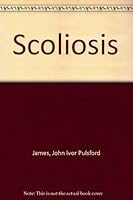 Scoliosis 0443015171 Book Cover
