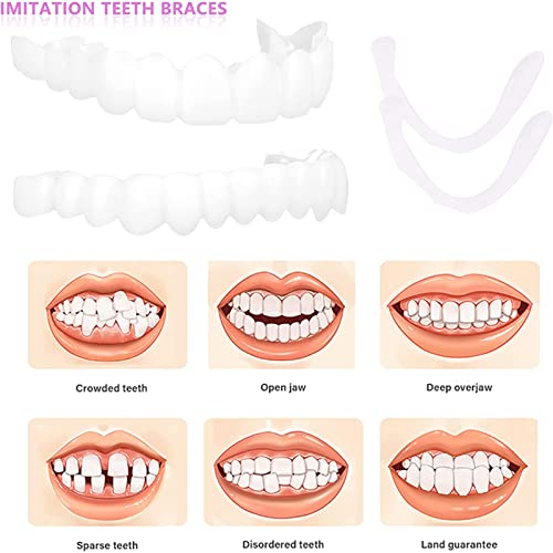 Fake Teeth,Veneers Teeth For Women And Men Used To Cover Missing, Material, Irregular,Teeth（2Pc） #TOP5