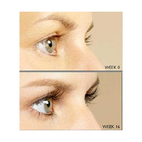 AS SEEN IN VOGUE – Spectaculash Advanced Eyelash Growth Serum – Rapid Growth and Thickness Enhancer – Eye Lash Growing Serum for Long Lashes – Grow Natural Eyelashes – DERMAWORKS Skincare & Beauty UK