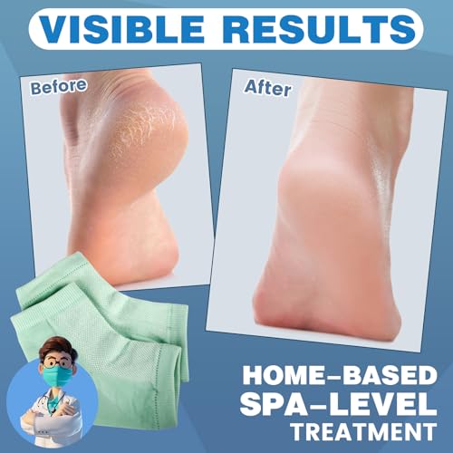 Image of TEAWOO 6 Pairs Green Moisturizing Heel Socks for Cracked Heel Treatment