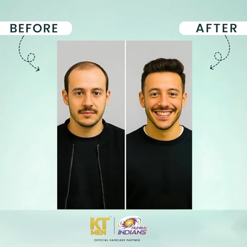 Image of Hair & Beard Growth Oil Serum | Dermatologist-Approved | Bhringraj & Rosemary | Thicker Fuller Hair + Anti Grey Protection | (Mumbai Indians) - 120 ml