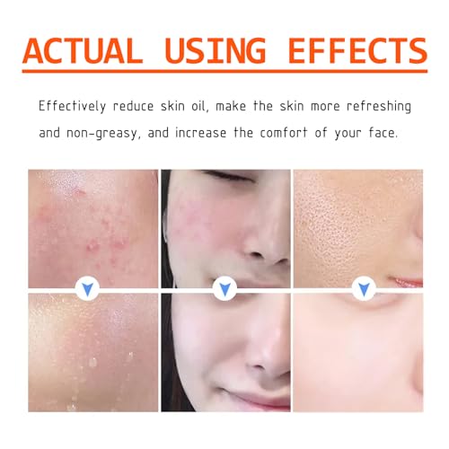 Cleansing and Mask with Salicylic Acid - Image 3