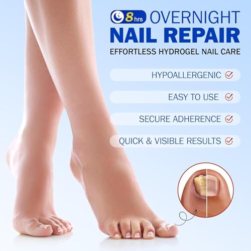 Fungal Nail Patch Treatment – Antifungal Toenail & Fingernail Solution | Kills Nail Fungus at Root | 10 Easy-to-Use Patches (H) - Image 2 thumbnail