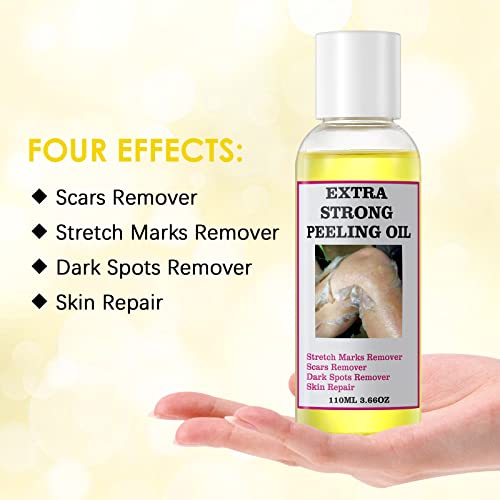 Peeling Oil For Dark Skin, Yellow Peeling Oil With Salicylic Sodium Hyaluronate, Strong Peeling Oil Extra Strength, Exfoliating Peeling Solution For Body All Skin Type - 110Ml/3.66 Oz #TOP3