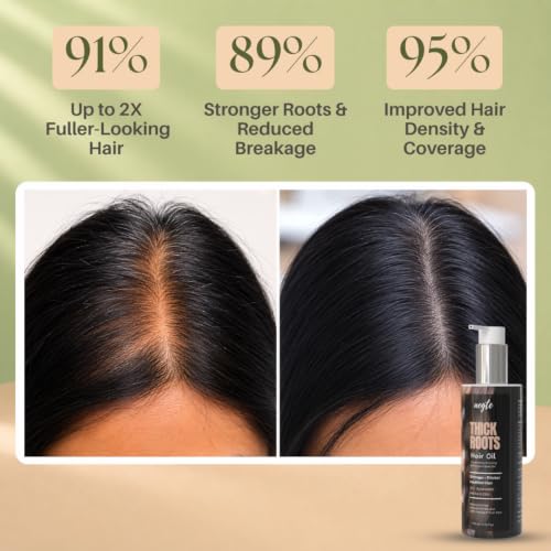 Image of Aegte Thick Roots Hair Oil With 20+ Ayurvedic Herbs | Natural DHT Blocker 100ml