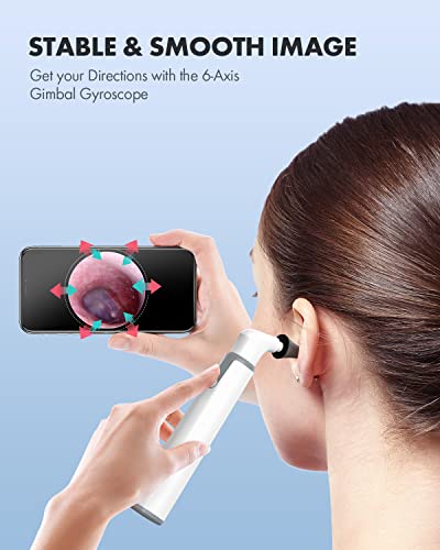 Scopearound SA39W Wireless Otoscope Ear Camera thumb #4