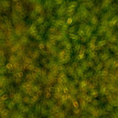 Caloric Restriction by Drugs Another Gift from our Microbiome