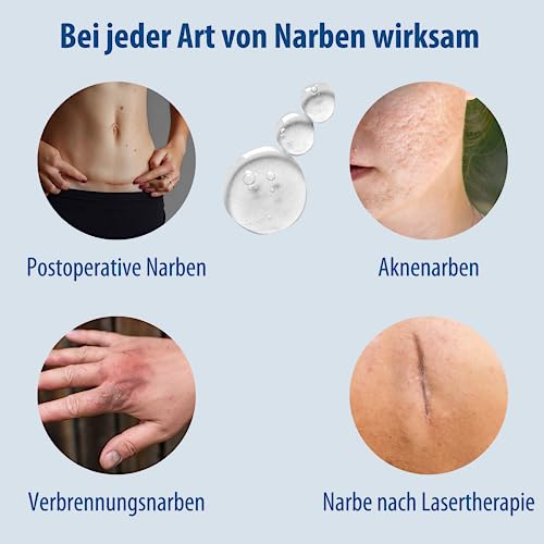 Narbensalbe Evolsin Narbengel für Kinder und Erwachsene