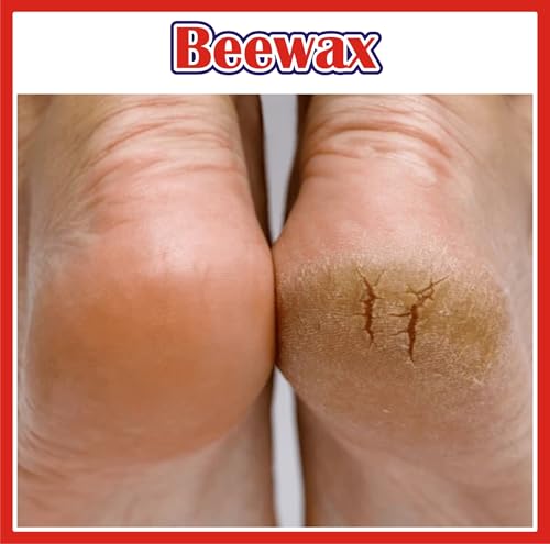 Image of Pure Natural Unrefined | Raw Beeswax | Bee Wax | Great for DIY Projects Like Skin Care Products | Body Lotions | Lip-Balm | Candles | Wood Polish Wax (100g)