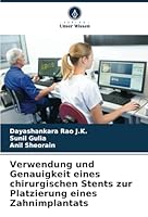 Verwendung und Genauigkeit eines chirurgischen Stents zur Platzierung eines Zahnimplantats 6208687497 Book Cover