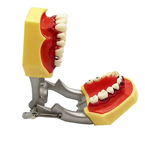 Modelo De Patología Periodontal - Modelo Didáctico De Dientes - Modelo Transparente De Dientes Con Enfermedad En Adultos - Simulación De Diente Oral Con Encías - Materiales Dentales Para La Cavidad Bu