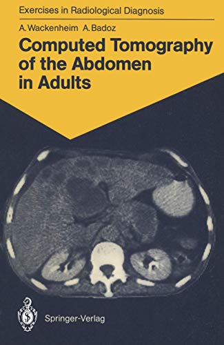 Computed Tomography of the Abdomen in Adults: 85 Radiological Exercises for Students and Practitioners (Exercises in...