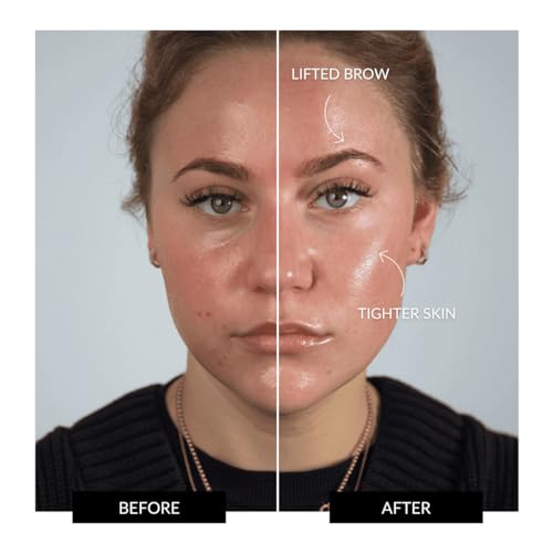 ZIIP Halo Facial Toning Device | Microcurrent and Nanocurrent Facial Device | Strengthening and Sculpting for Youthful, Glowing Skin | Anti-Aging at Home Use to Sculpt, Lift and Contour The Face - Thumbnail 5