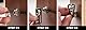 MusicNomad MN270 Acousti-Lok Strap Lock Adapter for Standard Output Jacks for Acoustic Guitars