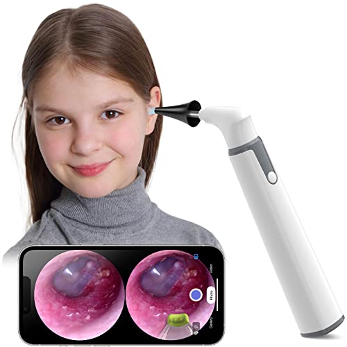 ScopeAround Otoscope with Light, Ear Camera w/Dual View, 720pHD WiFi Ear Scope w/ 6 LED Lights, 3.9mm Lens Otoscope Camera for Kids & Adults, Ear Scope Compatible w/Android & iPhone White