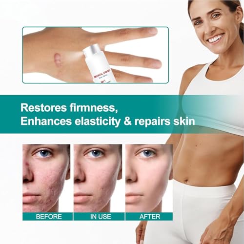 WANMATS Spray curativo per la Cura delle cicatrici, Formula avanzata per Tutti i Tipi di cicatrici, Trattamento per cicatrici da Acne, Spray per cicatrici di Grado Medico