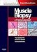 Muscle Biopsy: A Practical Approach: Expert Consult; Online and Print