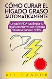 CÓMO CURAR EL HÍGADO GRASO AUTOMÁTICAMENTE: La guía RÁPIDA para limpiar tu hígado sin esfuerzo con el sistema “Desintoxicación en 7 DÍAS”. (dieta higado graso)