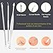 Pimple Popper Tool Kit - Boxoyx 10 Pcs Blackhead Remover Comedone Extractor Kit with Metal Case for Quick and Easy Removal of Pimples, Blackheads, Zit Removing, Forehead,Facial and Nose(All Silver)