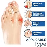 Zoom IMG-2 gliart orthoes calzini ortopedici per Zoom IMG-2 gliart orthoes calzini ortopedici per