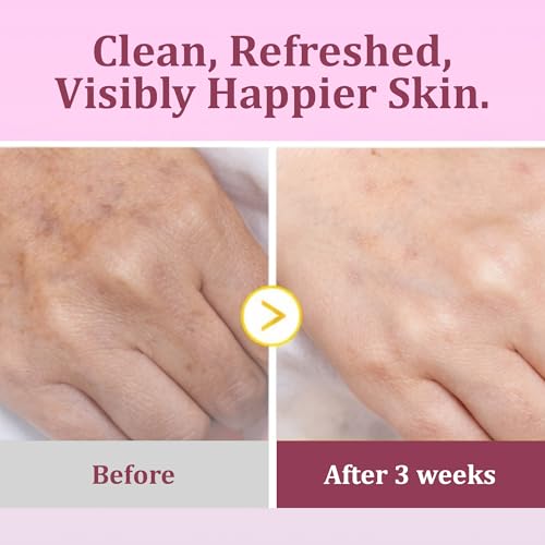 Eveloria™ Turmeric & Kojic Acid Toner Pads for Face – Brightening & Dark Spot Toner Pads with Vitamin C – Exfoliating Facial Toning Pads for Pore Minimizing, Uneven Tone & Acne Prone Skin (30 Pads)