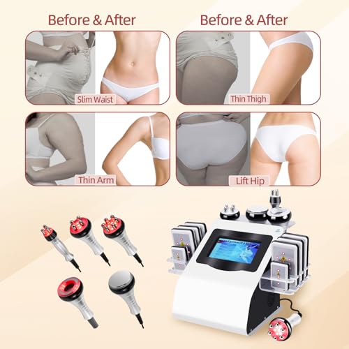 Expbom Body Machine Body Multifunctional Beauty Machine Cellulite Device, White
