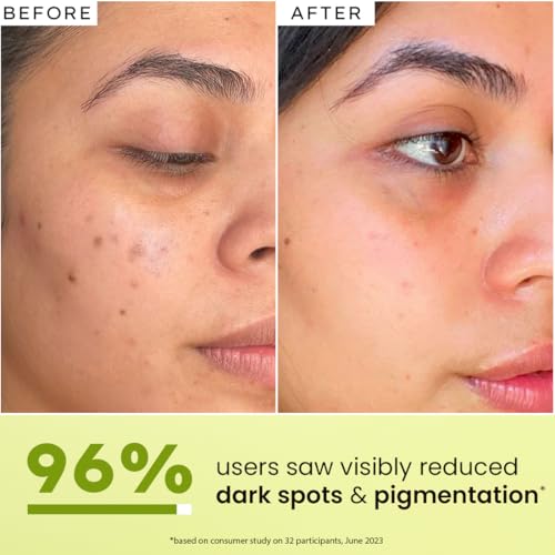 Image of Hyphen Daily Glow Defence Duo - Combo | Brightening Face Serum 15ml & All I Need Sunscreen SPF 50 PA++++ 30ml | Brightens + Protects with Niacinamide,Vit C Rich Kakadu Plum| All Skin Types (Pack of 2)