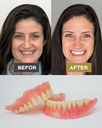 image for OTOOX Do It Yourself Denture Fake Teeth Top and Bottom Temporary Teeth