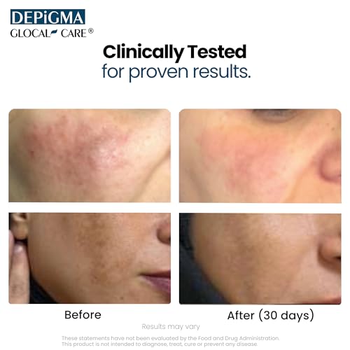 GlocalCare Depigma Hyperpigmentation Support Capsules