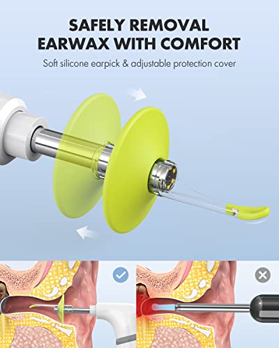 Anykit-Wireless-Otoscope-Ear-Camera-with-Dual-View-39mm-720PHD-WiFi-Ear-Scope-with-Ear-Wax-Removal-Tool-for-Kids-and-Adults-Pets-Compatible-with-Android-and-iPhone