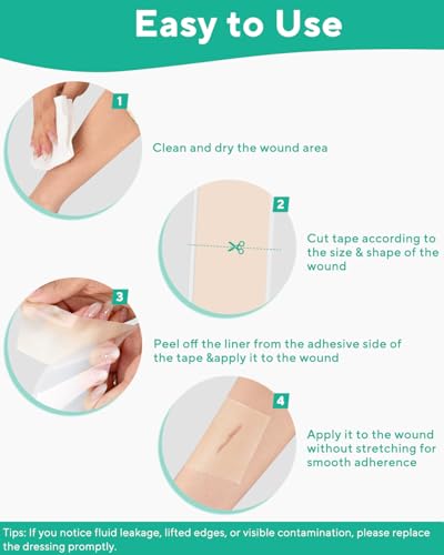 ZETRALL Hydrocolloid Roll for Wound Care, Large Cut-to-Size Hydrocolloid Patch Bandages wi - image 7