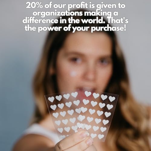 Heart Pimple Patches by HumanKINDglow – 48 Hydrocolloid Acne Patches for Face | Gentle Spot Treatment for Pimples & Blemishes | Cute White Heart Design for Confident, Kind Skin