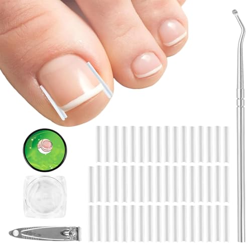 Ingrown Toenail Corrector Set, 50Pcs Ingrown Toenail Treatment Corrector, Professional Pain-Free Ingrown Toenail Removal Kit, for Men Women Foot Care