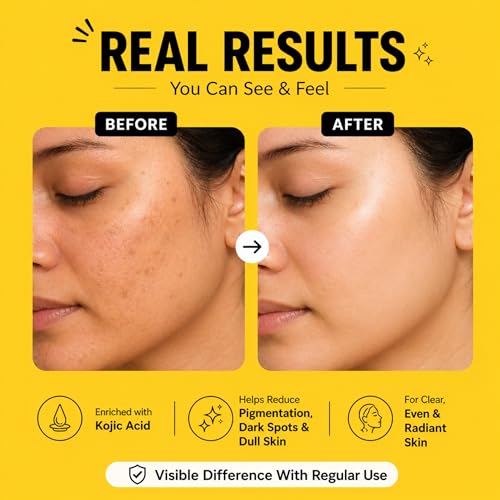 Image of Kojic Acid Soap For Skin Brightening | Tan Removal Soap Men and Women | Pack Of 3 (375g) | Pigmentation & Dark Spot Removal Bar with Vitamin E, Coconut Oil, Shea Butter & Olive Oil | Handmade | Skin Whitening | Kojic Acid Bar Bath