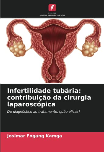Infertilidade tubária: contribuição da cirurgia laparoscópica: Do diagnóstico ao tratamento, quão eficaz?