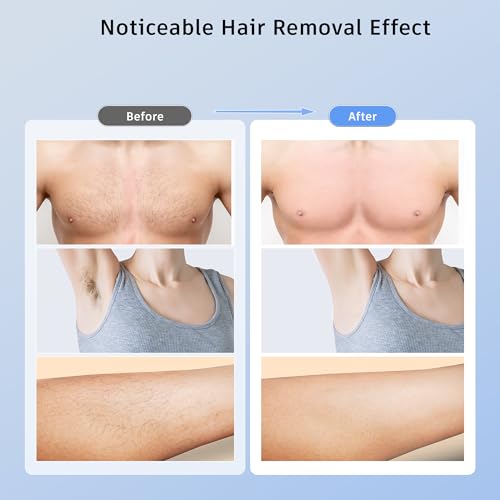 Image of Ubroo 5C Ice Cooling IPL Hair Removal Device, Low-Pain Pulse Light Hair Reduction Device for Adults, Works on Armpits, Bikini Line, Limbs and Facial Hair(Blue)