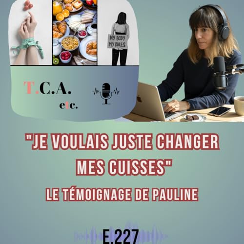 "Je voulais juste changer mes cuisses" - Le t&eacute;moignage de Pauline E.227