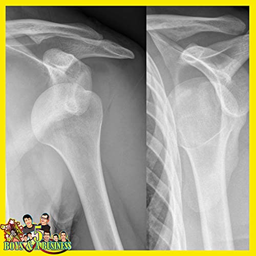 『HARRISON DISLOCATED HIS SHOULDER | Episode 86 | 5 Boys & A Business』のカバーアート