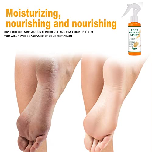 Removedor de Calo Pés,Revitalizante e Suavizante Spray Peeling Instantâneo para os Pés - Esfoliante