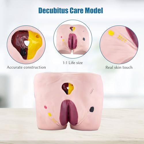 Image of JNMFTD Geriatric Decubitus Ulcer Nursing Model, 4 Stages Pressure Ulcers Advanced Nursing Elderly Bedsore Human Model Wound Kit with Product Manual Card for Hospital Medical Education Study