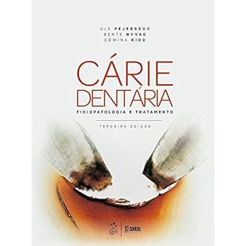 Capa do livro Cárie dentária: fisiopatologia e tratamento