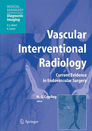 Vascular Interventional Radiology: Angioplasty, Stenting, Thrombolysis and Thrombectomy (Medical Radiology / Diagnostic Imaging)