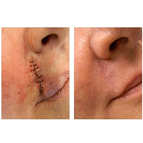 Strataderm 5g Gel De Silicone Tratamento De Cicatrizes